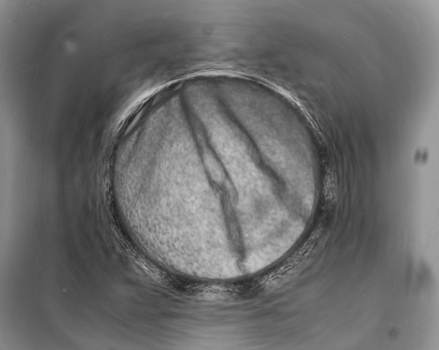 X0000098181359200805151131