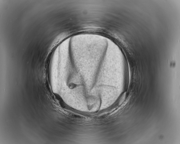 X0000098181362200805151131