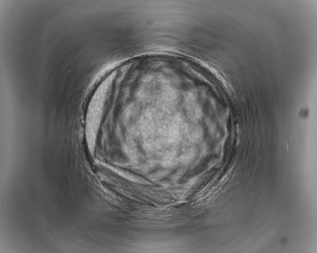 X0000098181363200805151130