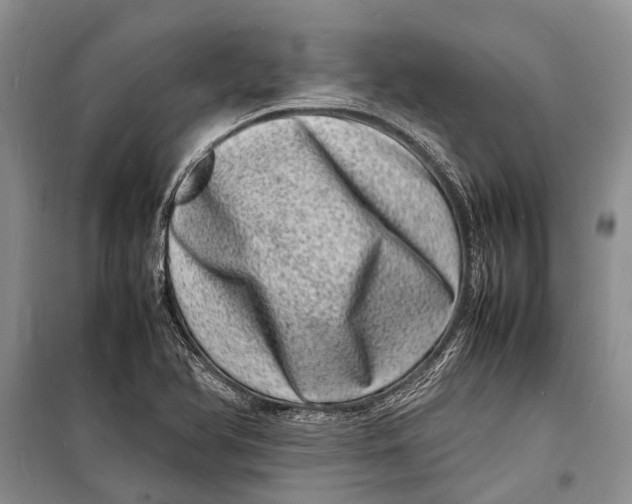 X0000098181366200805151130