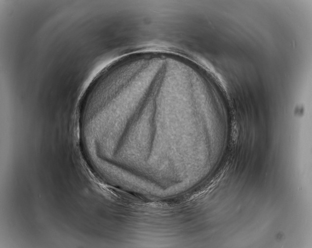 X0000098181368200805151130