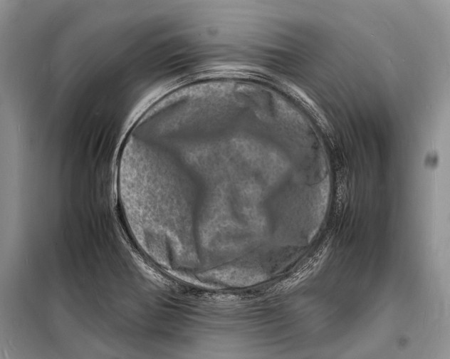 X0000098181370200805151130