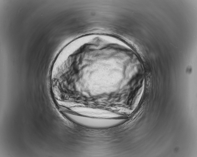 X0000098181375200805151130