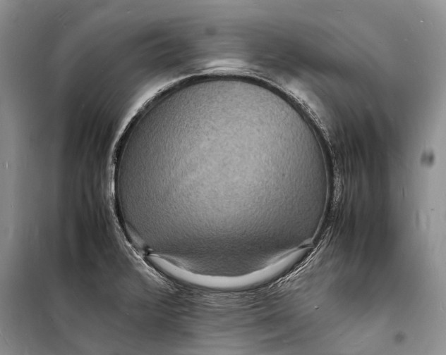 X0000098181376200805151130