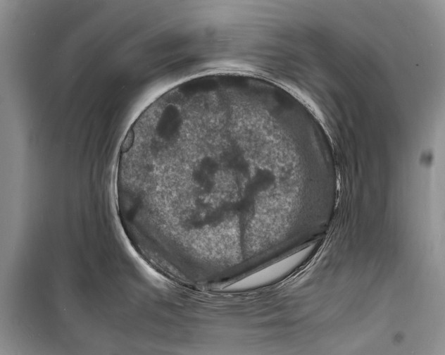 X0000098181391200805151130