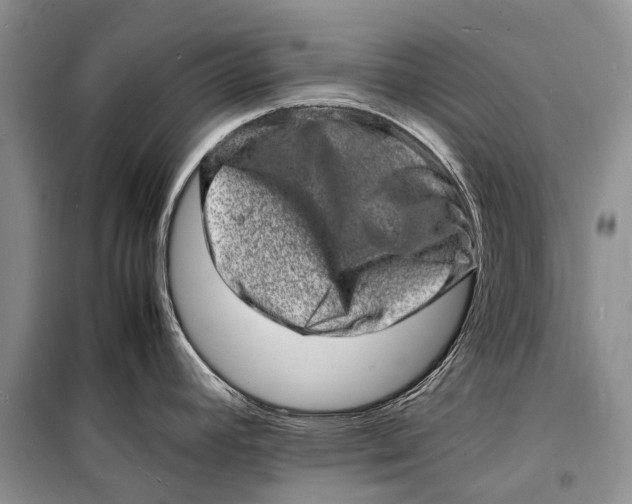 X0000098181392200805151130