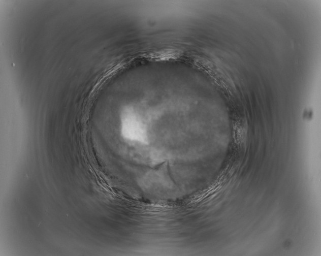 X0000098181393200805151129