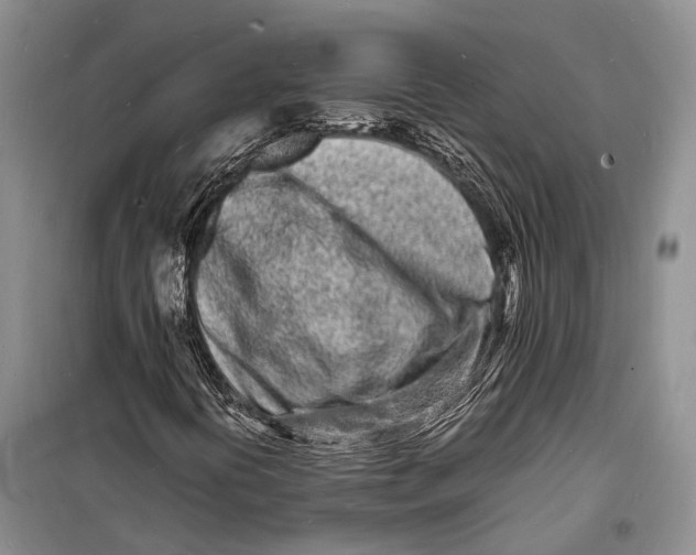 X0000098181394200805151129