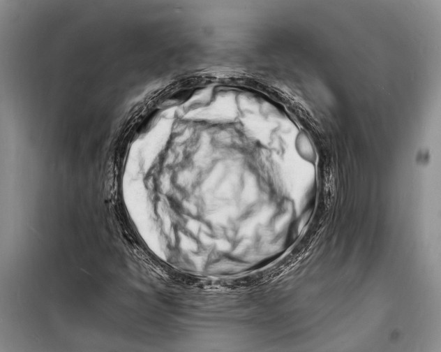 X0000098181398200805151129