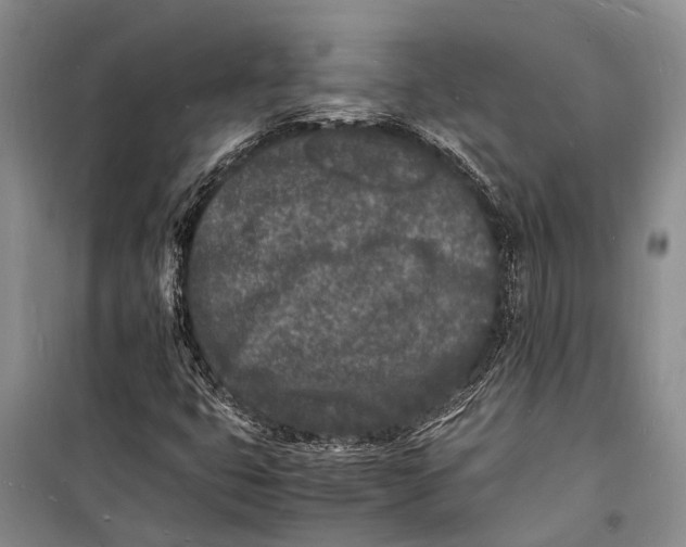 X0000098181399200805151129