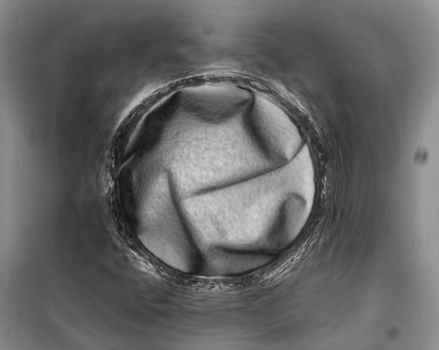 X0000098181400200805151129