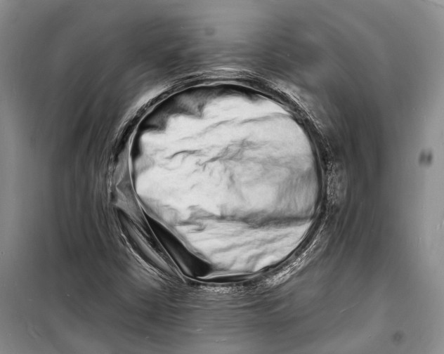 X0000098181402200805151129