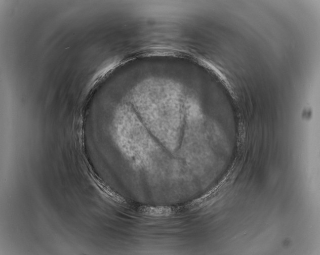 X0000098181403200805151129