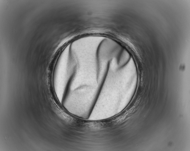 X0000098181404200805151129