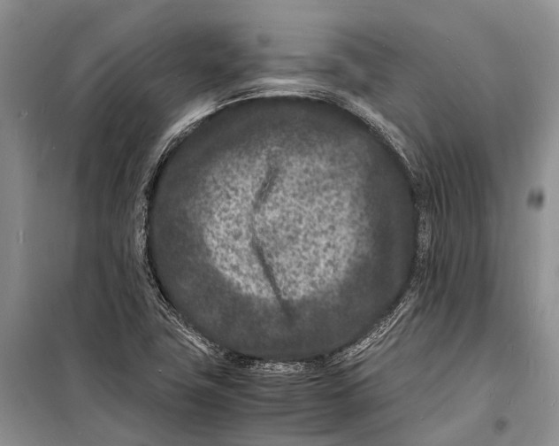 X0000098181411200805151129