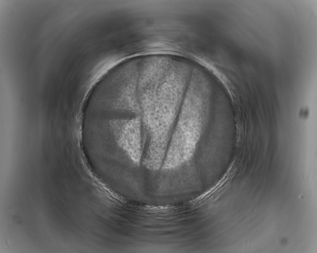 X0000098181415200805151130