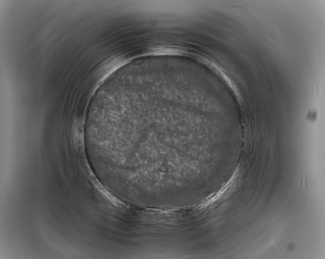 X0000098181417200805151130