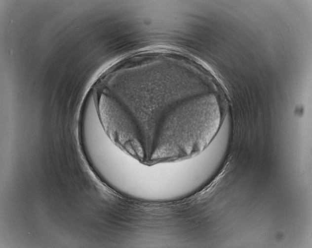 X0000098181418200805151130