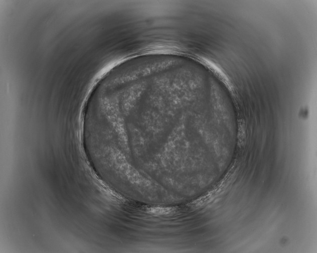 X0000098181419200805151130