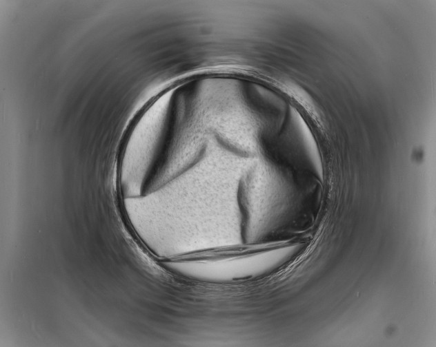 X0000098181420200805151130