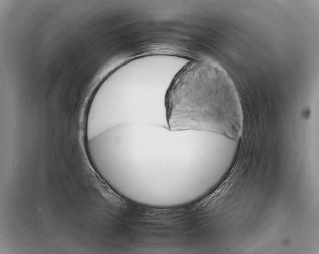 X0000098181427200805151130