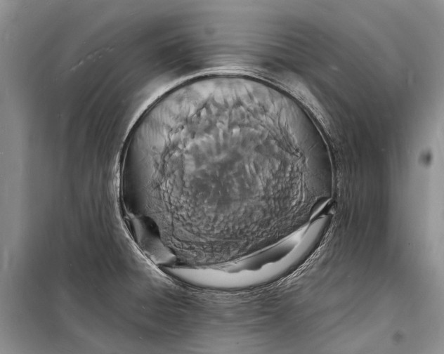 X0000098181428200805151130