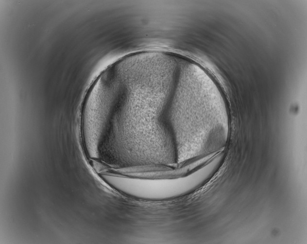 X0000098181432200805151130