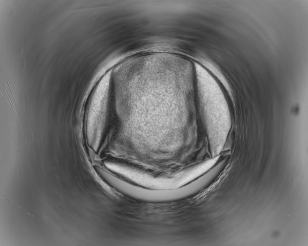 X0000098181437200805151130