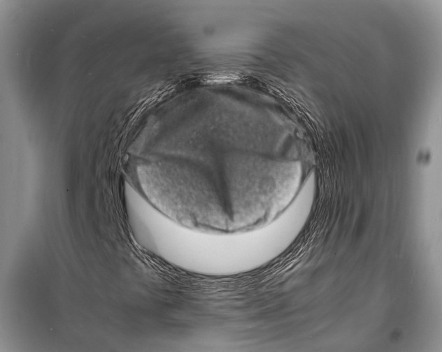 X0000098181441200805151129