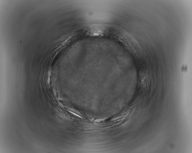 X0000098181442200805151129