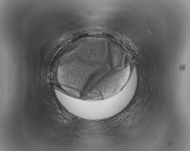 X0000098181445200805151129