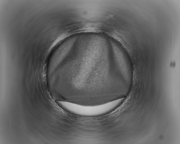 X0000098181450200805151129