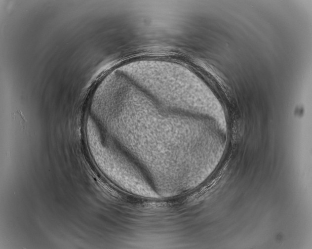 X0000098181451200805151129