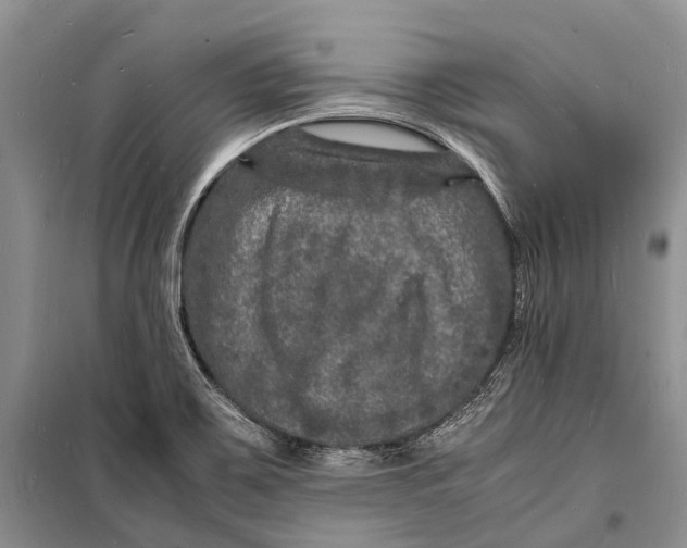 X0000098181467200805151129