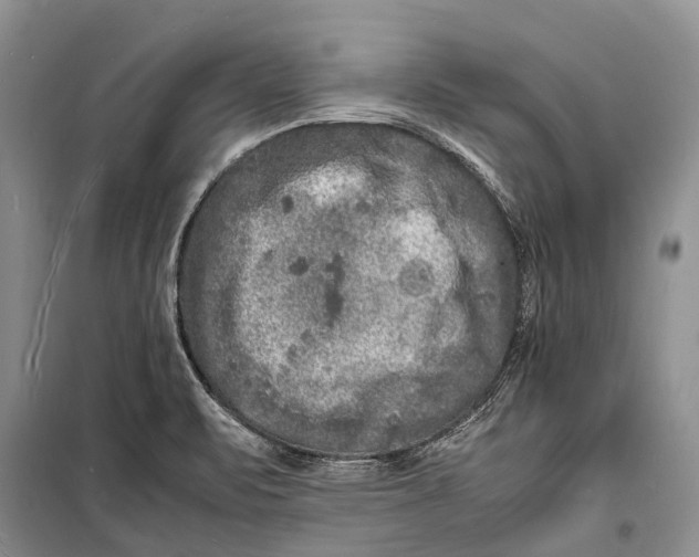 X0000098181471200805151129