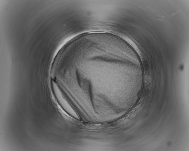 X0000098181485200805151128