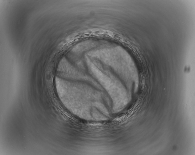 X0000098181489200805151128