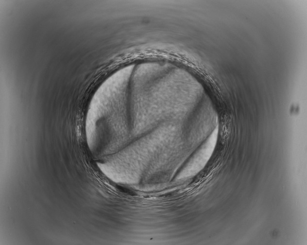 X0000098181490200805151128