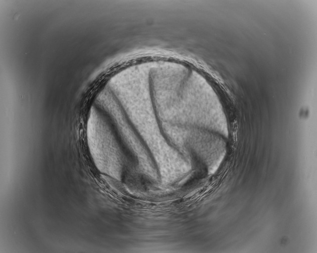 X0000098181495200805151128