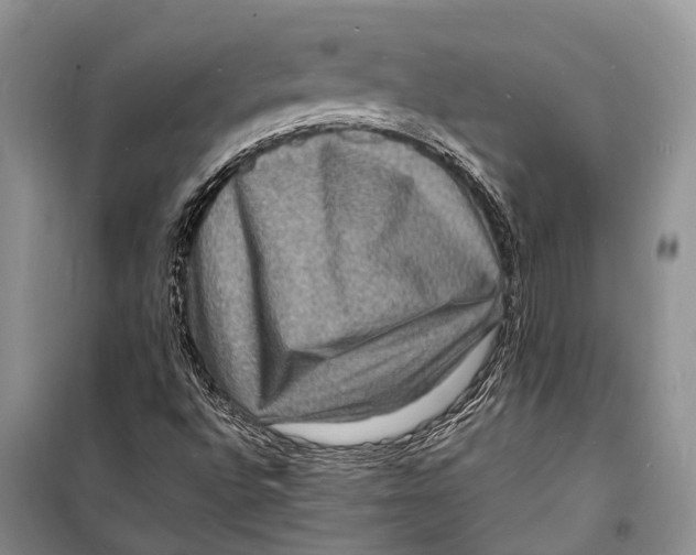 X0000098181496200805151128