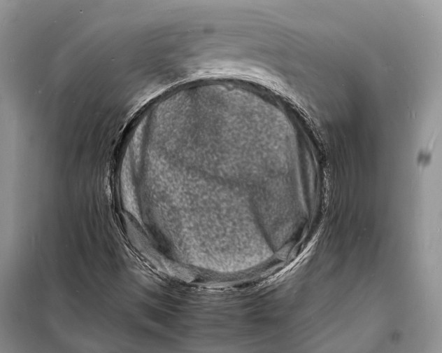 X0000098181497200805151128