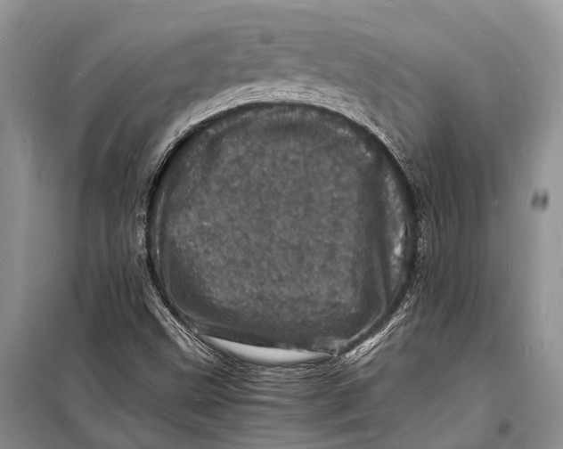 X0000098181499200805151128