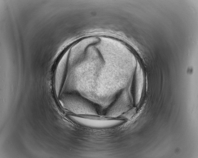 X0000098181501200805151128