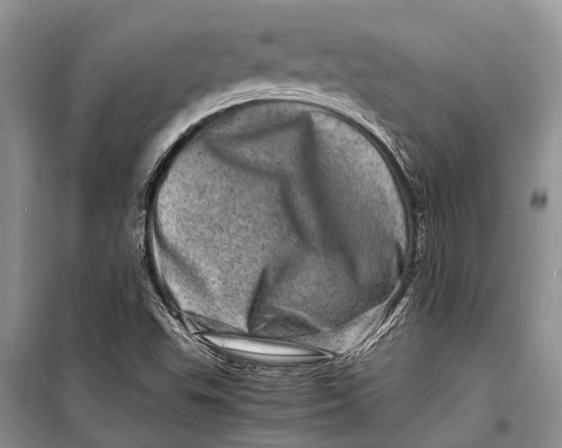 X0000098181503200805151128