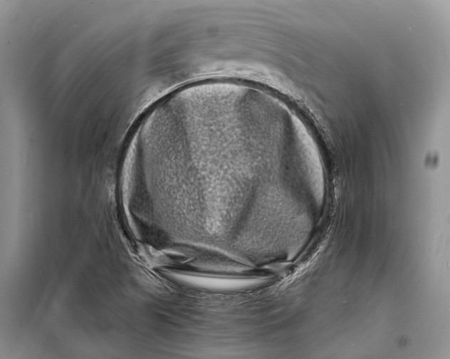 X0000098181505200805151128