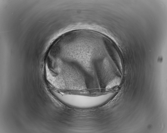 X0000098181507200805151128