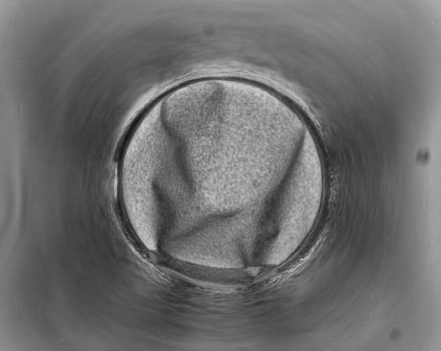 X0000098181509200805151128