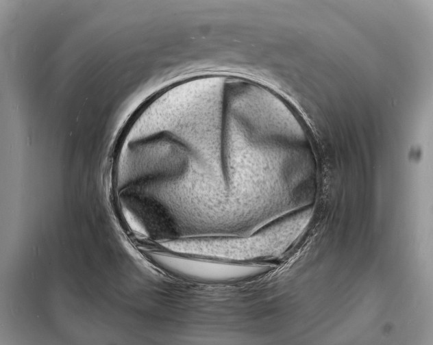 X0000098181511200805151128