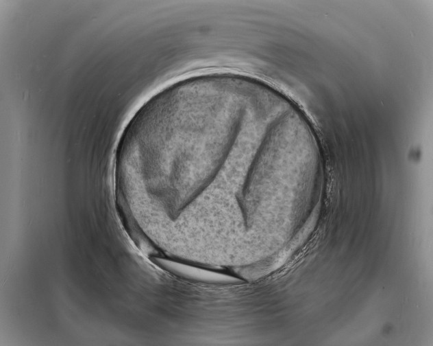 X0000098181516200805151128