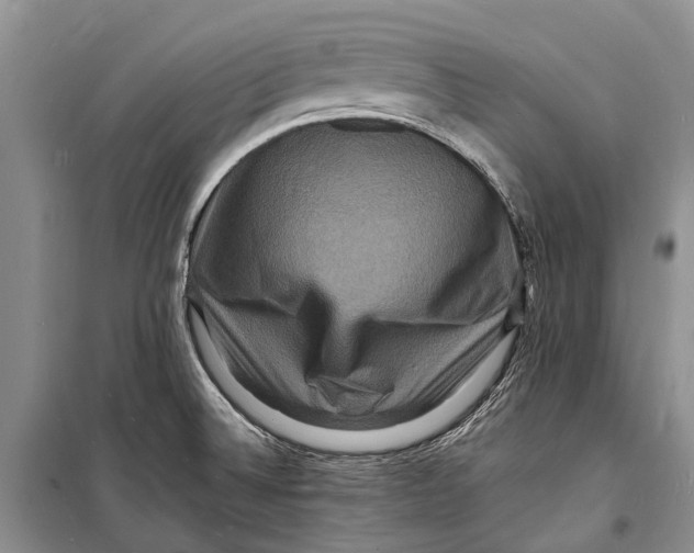 X0000098181524200805151128